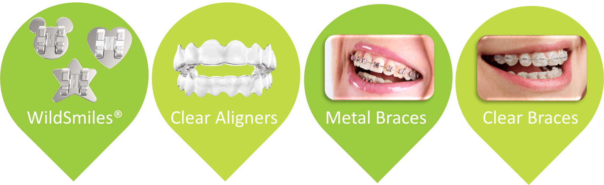 Types of Braces Spring Pediatric Dentistry & Orthodontics Lynwood WA